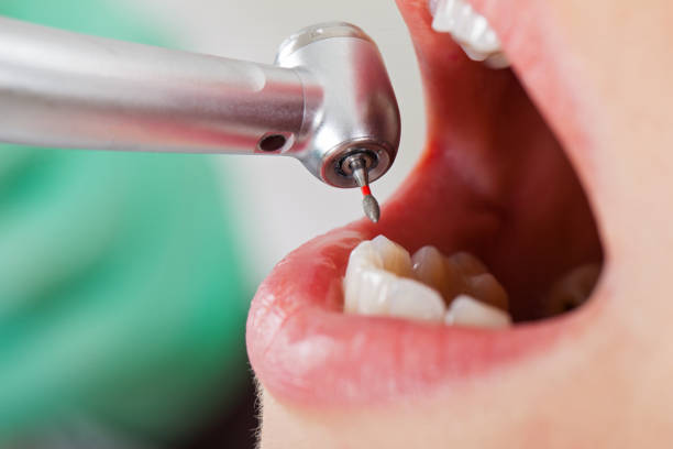 Best Emergency Treatment for Jaw Pain or Injury in Timmonsville, SC